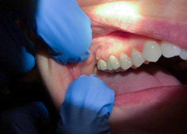 Best Urgent Dental Care for Toothache in Lesslie, SC